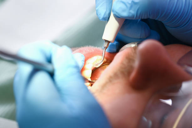 Best Urgent Care for Lost Fillings or Crowns in Lockeford, CA