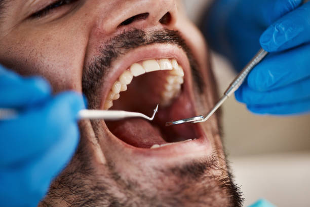 Best Cosmetic Emergency Dentistry in Lockeford, CA